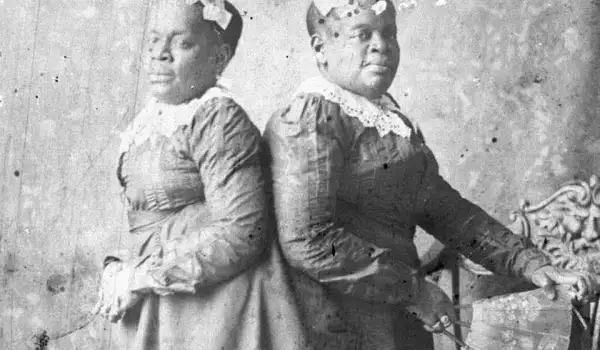 Трогателната история на сиамските близначки от Северна Каролина