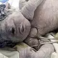 Новородено само с 1 око доказа, че циклопи са съществували