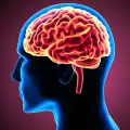 Учените създадоха мозъчен имплант, който преобразува мислите в реч