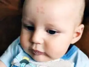 Бебе се роди с надпис 12 на челото