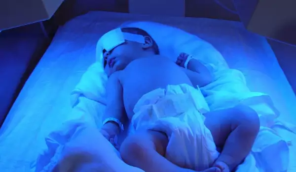 Лекарят-самозванец, който спаси хиляди недоносени бебета в музей