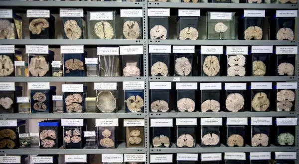 Уникален музей на болните мозъци стряска в Перу