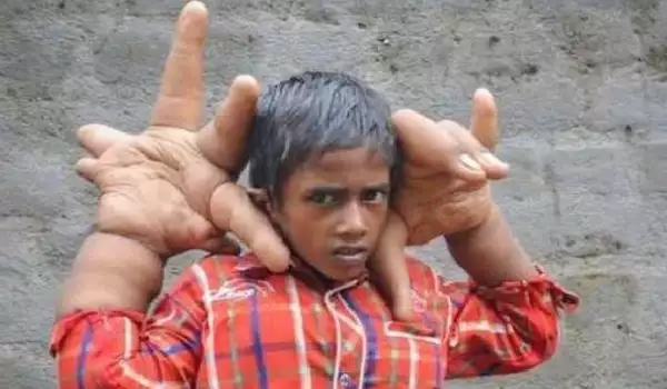 Момче от Индия изумява с необикновените си ръце