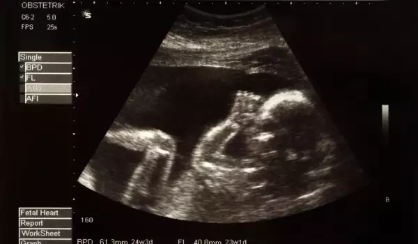 Ембрион-паразит расте в корема на китайско момиче