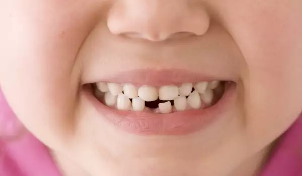 Зъби