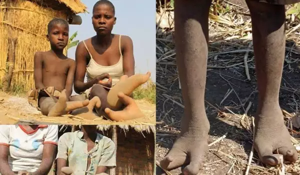 Вижте необикновеното племе Вадома – хората с щраусови крака