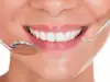 Кътни зъби