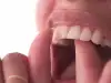 Зъб